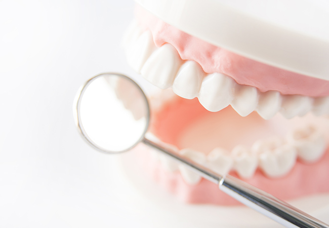 歯の模型とデンタルミラー